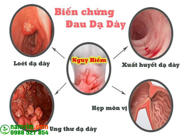 Bien Chung Nguy Hiem Da Day