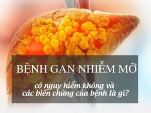 Benh Gan Nhiem Mo Co Nguy Hiem Khong